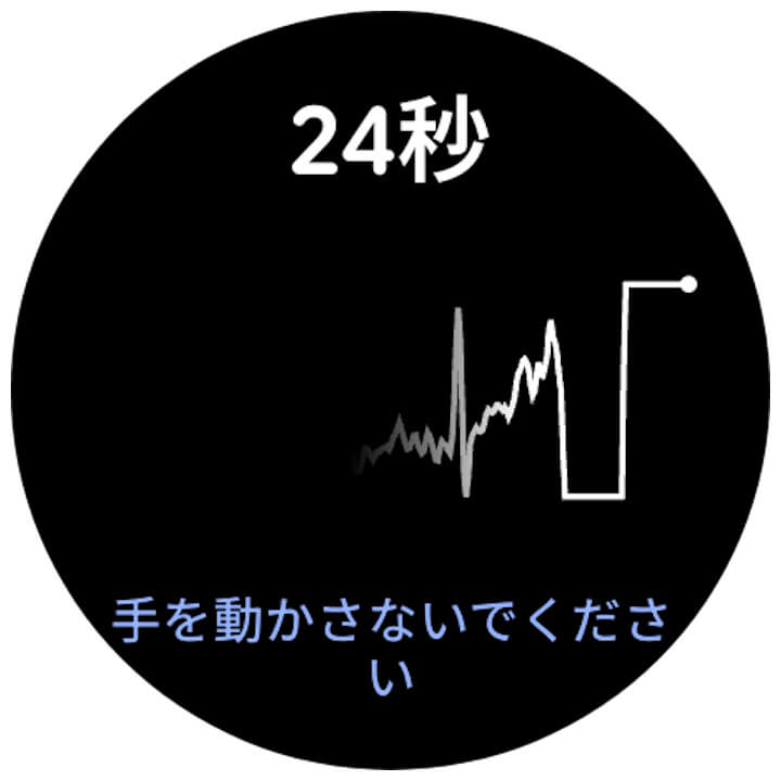 Fitbit ECG